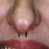 Septum